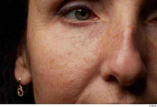 HD Face skin Alicia Dengra cheek eye nose pores skin…